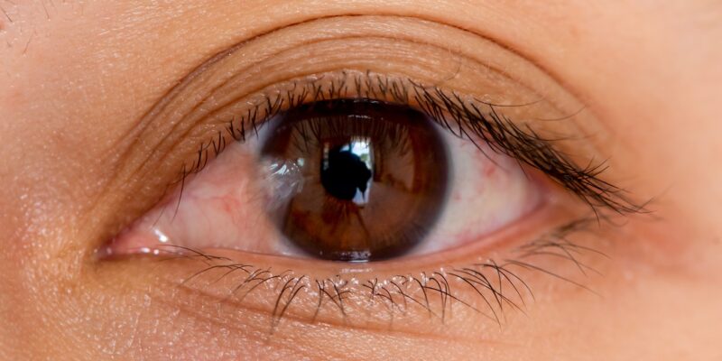 ouston Lasik & Eye